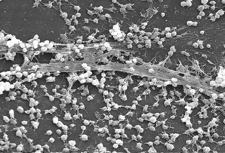 Biofilm - Quelle: public-domain-image.com